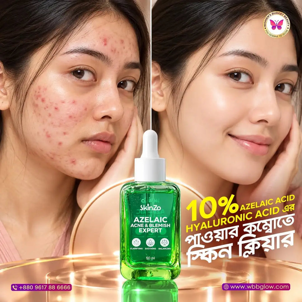 Skinzo Azelaic Acne & Blemish Expert