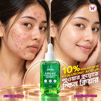 Skinzo Azelaic Acne & Blemish Expert