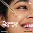 Skinzo Azelaic Acne & Blemish Expert