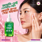 Skinzo Azelaic Acne & Blemish Expert