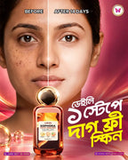 Skinzo Sophora Spot Eraser Serum